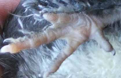 Brachydactyly